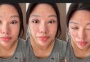 Hidup dengan Mata Tak Bisa Tertutup: Kisah Wang Li Usai Operasi Gagal